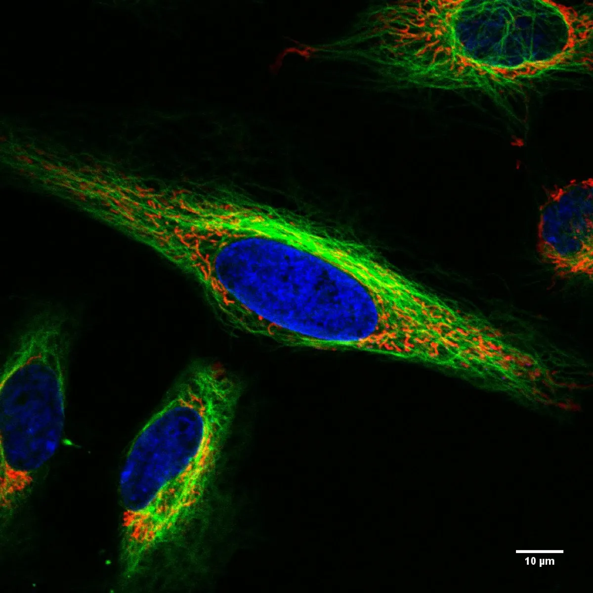 Living HeLa cell, fluorescence microscopy